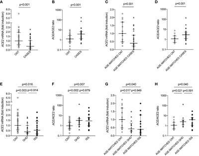 Children With Short Stature Display Reduced ACE2 Expression in Peripheral Blood Mononuclear Cells